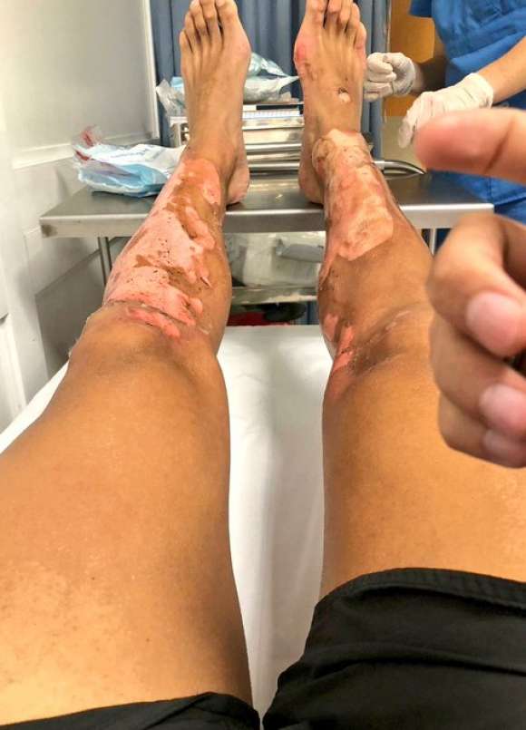 incidente cardacio foto